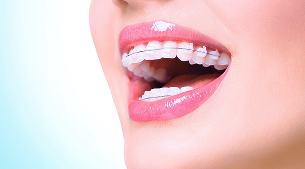 Clínica-Dental-Barcelona-Ortodoncia-Olivieri